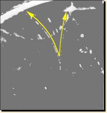 A pair of particles makes a fog spot as they pass through the wet air of a "cloud chamber"